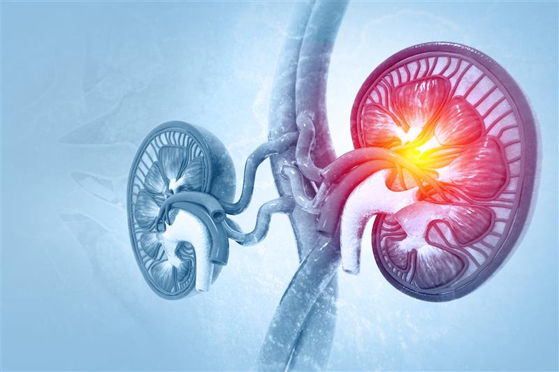 Kidney transplantation